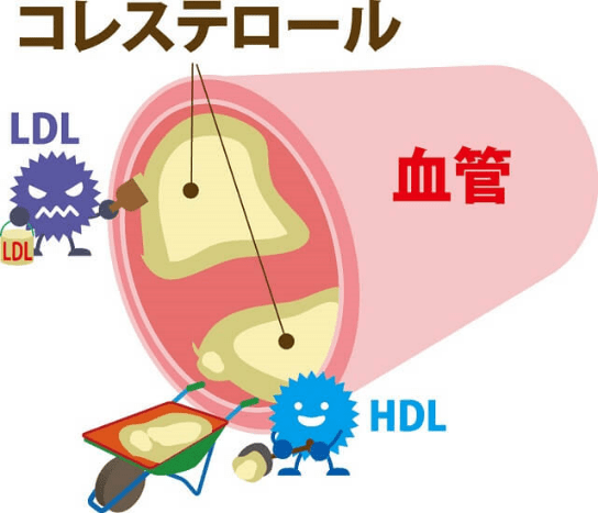 ●コレステロールとは？ コレステロールには、悪玉コレステロール（LDLコレステロール）と善玉コレステロール（HDLコレステロール）があります。LDLコレステロールは動脈硬化の原因になるといわれており、HDLコレステロールは余分なコレステロールを減らす役割があります。 一般的に、LDLコレステロールが140mg/dL未満、HDLコレステロールが40mg/dL以上の場合、正常です。
