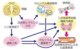 〈腎臓が弱くなると、骨も弱くなる？？～カルシウム、ビタミンD、リン、PTH～〉骨の材料となるカルシウムは、腸管で吸収され血液によって骨に運ばれます。カルシウムを腸管で吸収するにはビタミンＤが必要になりますが、そのビタミンＤはそのままの状態では働いてくれません。腎臓でビタミンDが活性化され、活性型ビタミンＤに変わることで、腸管からカルシウムを効率よく吸収できるようになります。 慢性腎臓病で腎臓の機能が低下すると、ビタミンＤの活性化がスムーズに行われず、食事でカルシウムを摂っても吸収がうまくできなくなり、血液中のカルシウム濃度が低下します。一方、慢性腎臓病で腎臓の機能が低下すると、尿中へのリンの排泄機能が低下するため血液中のリン濃度が上昇します。そのため、カルシウムとリン濃度の異常を調節するために、副甲状腺ホルモン（PTH）が増加します。PTHは骨から血液中へとカルシウムを移動させる働きを持つため、PTHが増え続けると骨からカルシウムが溶け出て補おうとするので、骨は次第に弱くなってしまいます。